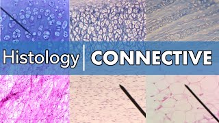 Histology  Connective Tissue [upl. by Rimas550]