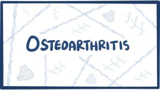 Osteoarthritis vs rheumatoid arthritis symptoms  NCLEXRN  Khan Academy [upl. by Rockel]