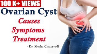 Ovarian Cyst Causes Symptoms and Treatment [upl. by Keely]