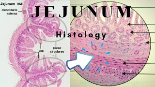 The Pathology of Melanoma [upl. by Arannahs]