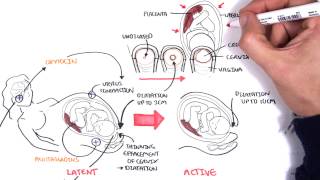 Obstetrics  Stages of Labour [upl. by Econah]