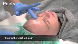 How to treat melasma pigmentation [upl. by Rraval589]