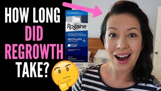 WHAT TO EXPECT WHEN STARTING ROGAINE OR MINOXIDIL HOW LONG DOES IT TAKE TO WORK And Weddings Talk [upl. by Aikyn]