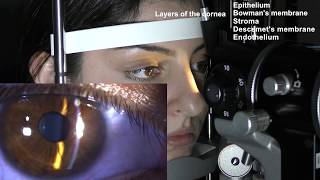 Ophthalmic Skills Series Part 15 [upl. by Leor995]